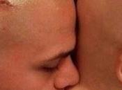 Padre tatúa cicatriz hijo superó cáncer