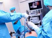¿Qué esterilización laparoscopia?