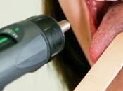 síndrome Sjogren: Causas, síntomas tratamiento