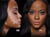 Maquillaje para vitiligo.Protección manchas.