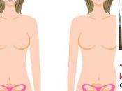 Miomas tumores afectan mujer