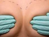 Cirugía mamas