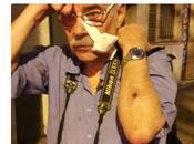 Fotógrafo Telam agredido policía encuentro nacional mujeres Rosario