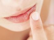 Consejos para cuidar labios agrietados