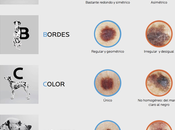 Método ABCDE Roche Posay: amas alguien, chequeale lunares.