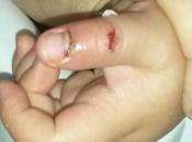 Primer Accidente meses)