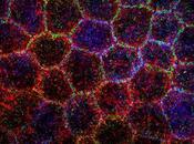 Córnea transparente, córnea sana