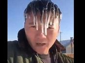 pelo hombre congela causa frío extremo