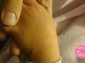 Escarlatina: enfermedades vuelven. pasó hija