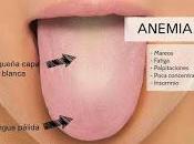 lengua salud..Según forma color.