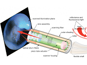 Camara Laser Capaz Detectar Eventos Cardiovasculares