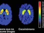 Prueban Metodo para suprimir Adiccion Drogas