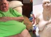 Sufrimiento innecesario: vivió años tumor kilos