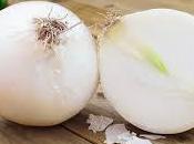 Somos como capas cebolla