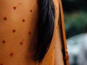 Trend Alert: Plumeti