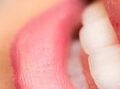 Implantes dentales, opción para aquellos pierden dientes.