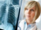 puede romper costilla mientras tose?