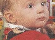 Implante Coclear Niños. edad hacerlo?