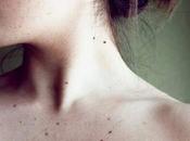 ¿Por tenemos lunares?