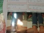 Alineamiento vertebral