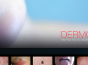 Dermomap primera aplicación para ayuda diagnóstico patologías cutáneas