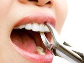 ¿Puede extracción diente causar agujero macular?