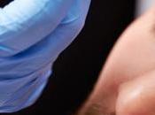 Cirugía plástica, nueva tendencia entre hombres millennials