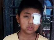 Piden apoyo para niño pierda vista