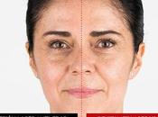 ¿Sesión Láser Anti-Edad Revitalift Laser L'Oréal París?