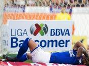 chileno Rodríguez sale fuerte lesión triunfo Cruz Azul