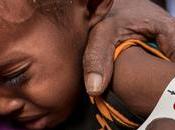 Complicidad Solidaria: "Desnutrición Somalia"