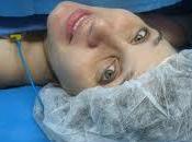 Todo sobre anestesia epidural cesárea