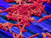 Superbug Clostridium Difficile está punto superar MRSA hospitales
