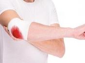 4.990 #venezolanos padecen enfermedades hemorrágicas #Medicina #Salud