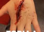 Fobia sangre agujas