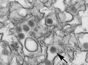 Zika como virus antitumoral…