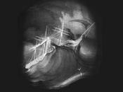 [Disco] Gente Joven Glub (2017)