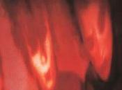 Cure Hanging Garden (1982)