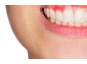 Reemplazo permanente dientes futuro: ¿puedes hacer crecer diente perdido?