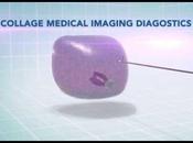 Tecnología israelí revoluciona detección cancer