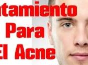 Como Quitar Rapidamente Acne Algunos Remedios Caseros