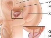 Problemas prostata