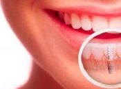 Implantes dentales, ¿que debemos saber antes elegir donde colocarnoslos?