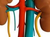 Diagnóstico: I.R.C (Insuficiencia Renal Crónica)