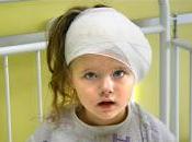 Traumatismo Craneal Vómitos Aislados rara indica Lesión Cerebral