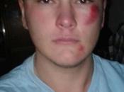 Argentina. Otro ataque homofóbico, ahora Tandil.