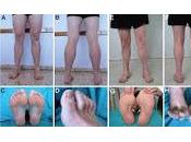 Desarrollan Fármaco para tratar Afecciones Neurodegenerativas