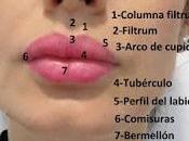Último