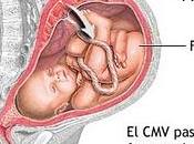 citomegalovirus pueden afectar bebé útero materno