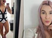 Manuela Gómez, arrepentida procedimiento dejó cola “tamaño familiar”